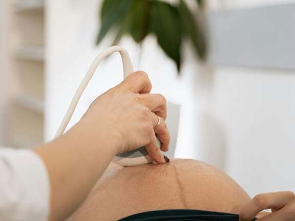 First trimester genetic screening (for baby)