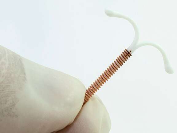 Intrauterine device (IUD/Mirena) insertion