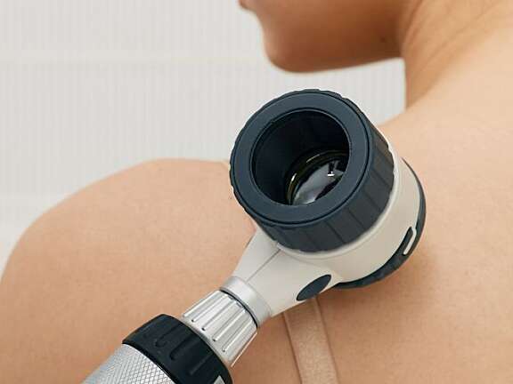 Skin cancer checks